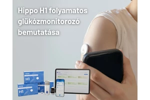 Miért érdemes a Hippo CGM-et választani cukorbetegeknek? – Hippo H1 folyamatos glükózmonitorozó bemutatása